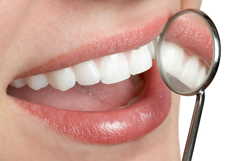 Smile Dental Works Dental Offer